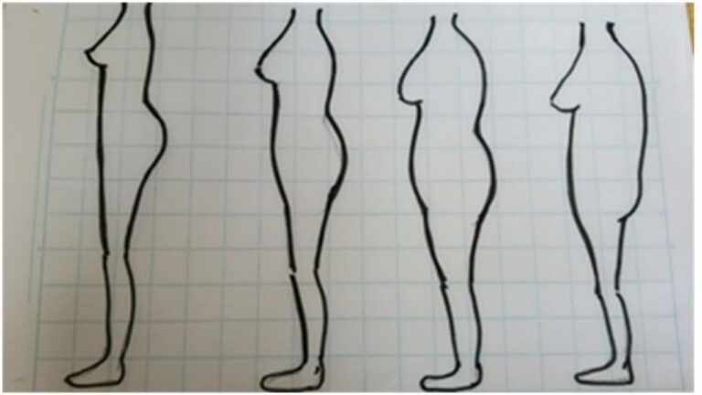 下腹と尻のムダ肉は”骨格マジック”で片付けちゃいませんか？