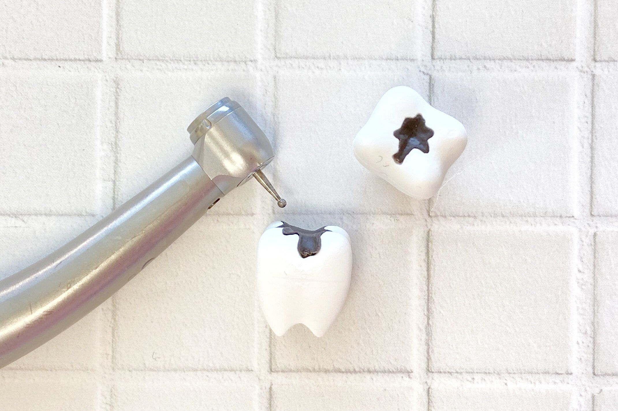 虫歯が嫌な人必見！【虫歯になりやすい歯】とは？