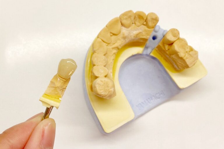 【歯科医が教える事実】実は〇〇の隣の歯が虫歯になることが非常に多い！