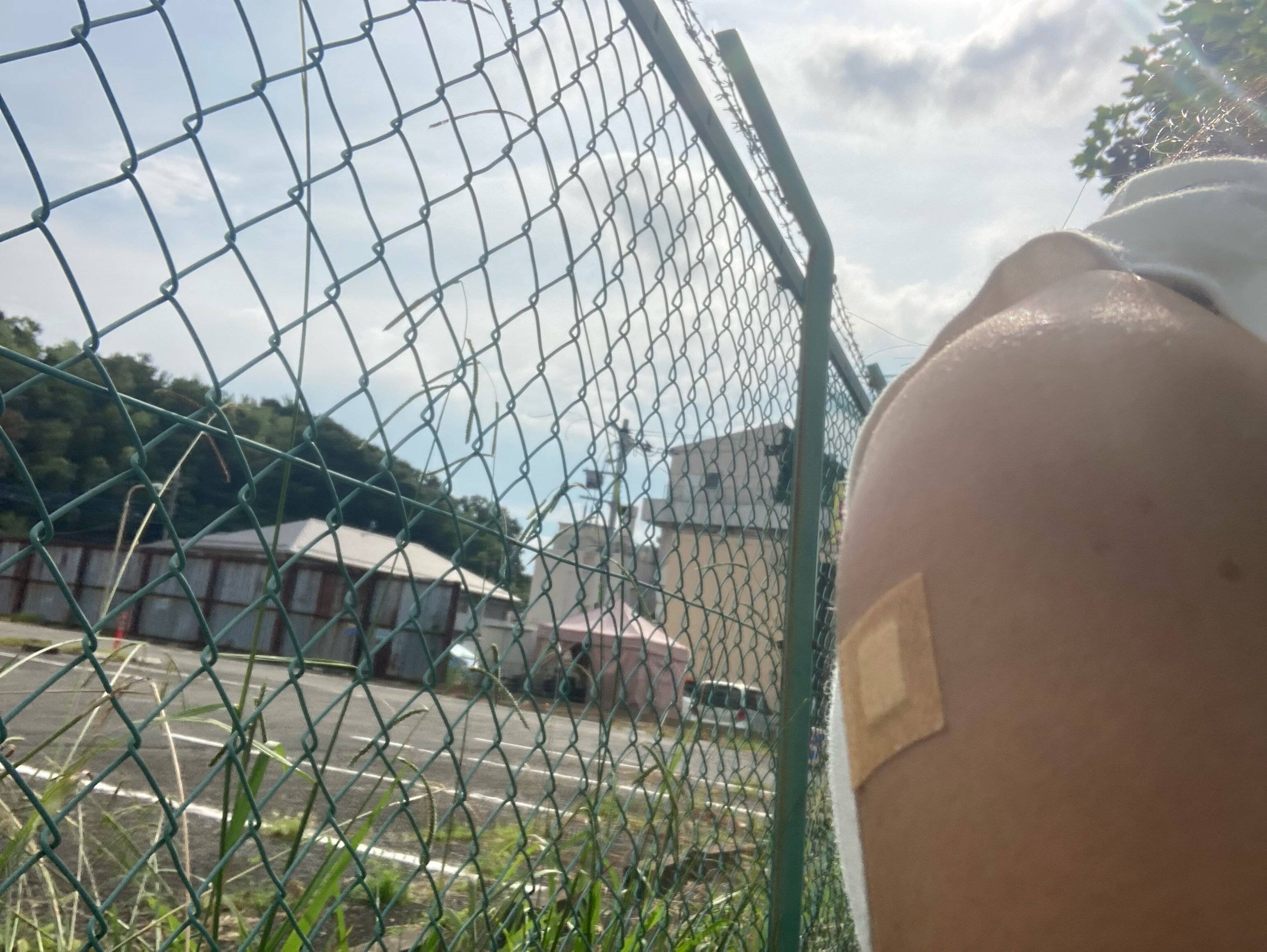 気管支拡張症も優先接種者として新型コロナワクチン受けられる？基礎疾患ありってどんな状態？