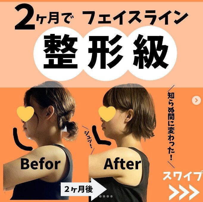 「2カ月でフェイスラインの変化は整形級！」36歳のママがあることを続けていたら、いつのまにか変わっていた!?