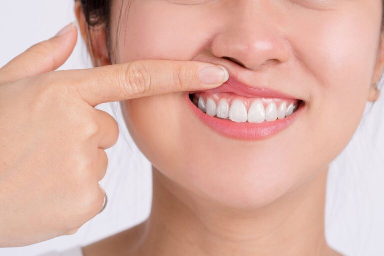 おじさんの悩みと思っていたら……35歳、女性ホルモンが減り始めると口臭リスクが一気に上がる