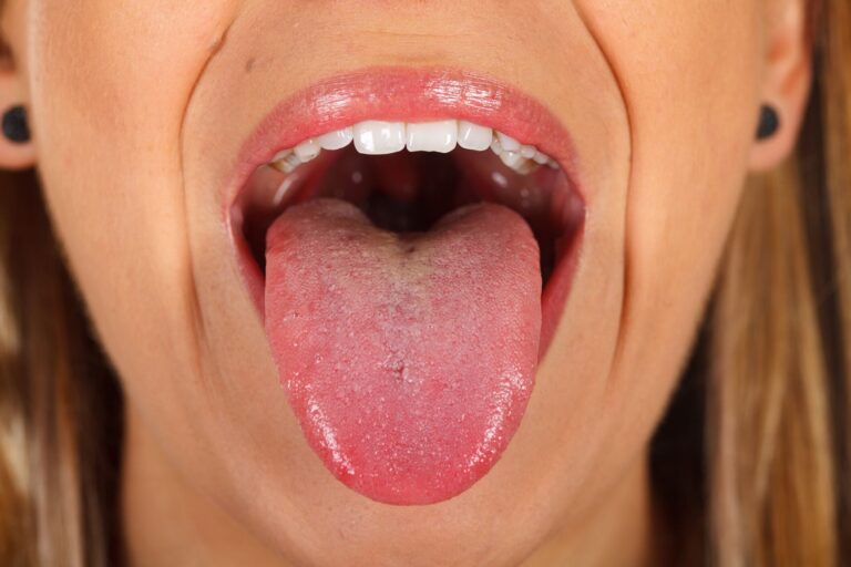 舌を見たらわかる!?自分の体調セルフチェック