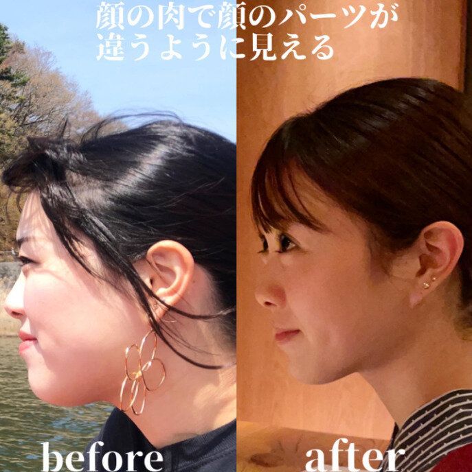 10kg痩せたら表情までこんなに変わる！ダイエットのコツは「いっぱい食べて、いっぱい動こう！」